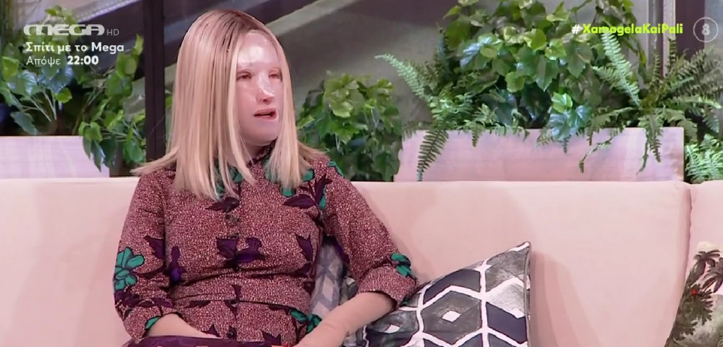 Συγκλονιστική η Ιωάννα Παλιοσπύρου – Όταν έβγαλα για πρώτη φορά τη μάσκα – Η νέα ζωή μου μετά την αποδοχή