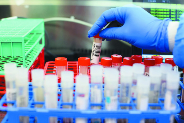 Κοροναϊός – Το πειραματικό χάπι της Merck για την Covid-19 μειώνει μόνο κατά 30% τον κίνδυνο νοσηλείας και θανάτου