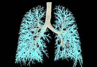Σχέδιο έγκαιρης διάγνωσης καρκίνου πνεύμονα μελετά το υπουργείο Υγείας
