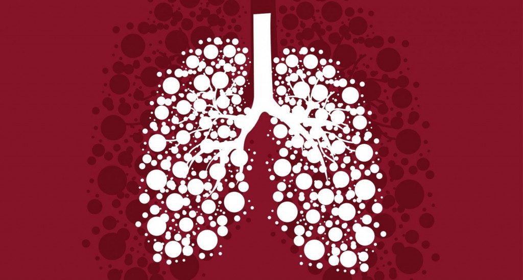 Ο καρκίνος του πνεύμονα αντιμετωπίζεται με πρώιμη διάγνωση