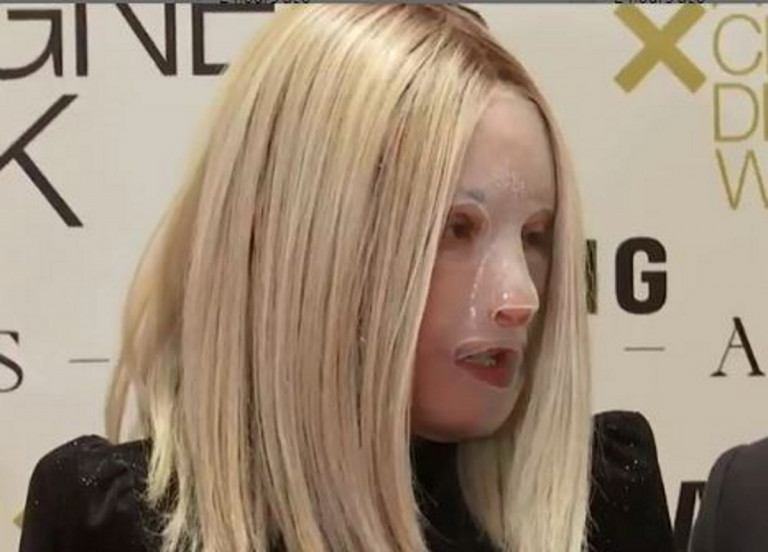 Επίθεση με βιτριόλι – Η πρώτη βραδυνή έξοδος της Ιωάννας μετά τον εφιάλτη