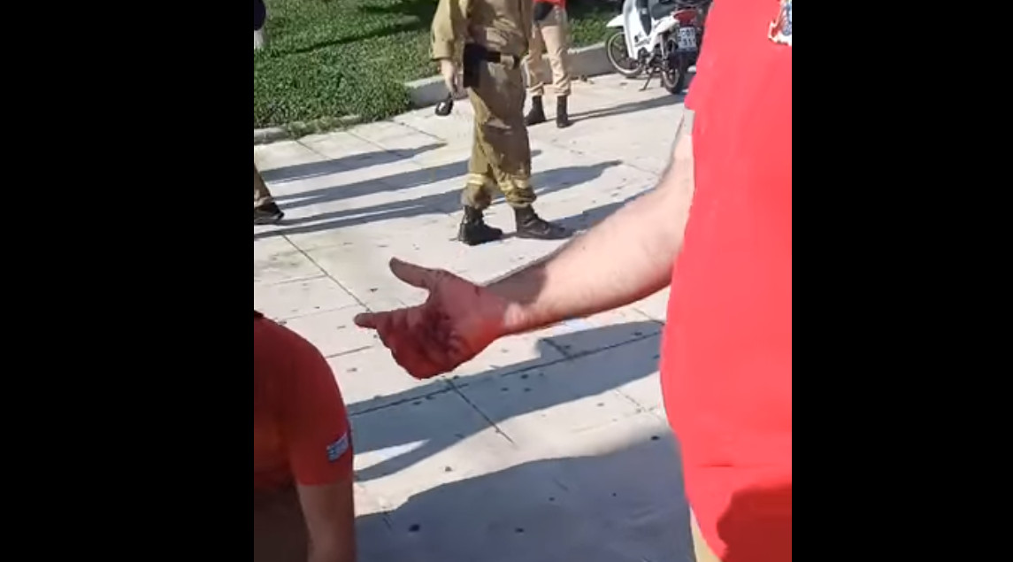 Πυροσβέστες - Σοκαριστικά βίντεο από τον τραυματισμό του διαδηλωτή
