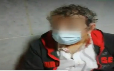 Θεσσαλονίκη – Σοκάρει ο ταξιτζής για τη συμπλοκή με πελάτη – «Με ξυλοκόπησε επειδή ζήτησα να βάλει μάσκα»