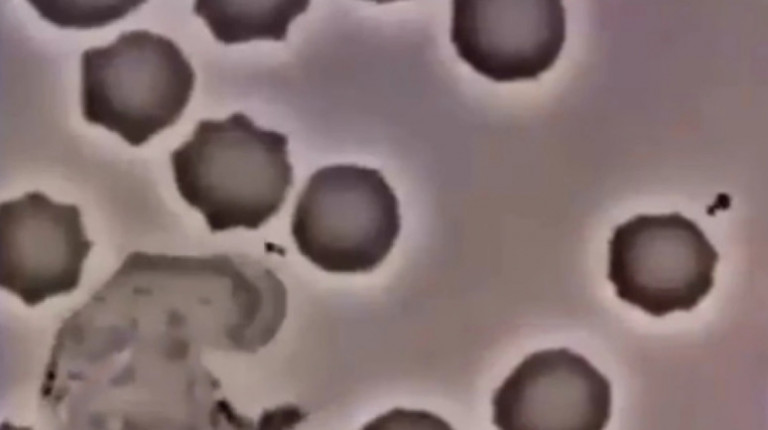 Ανοσοποιητικό σύστημα- Δείτε πως τα λευκά αιμοσφαίρια επιτίθενται σε ιούς