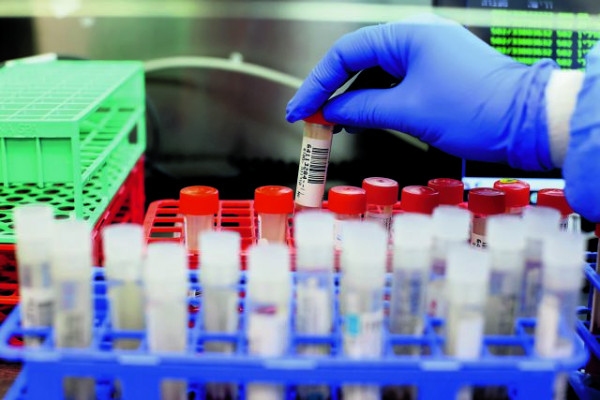 Κοροναϊός – Διευρύνονται τα κριτήρια για τα μονοκλωνικά αντισώματα – Σε ποιους χορηγούνται