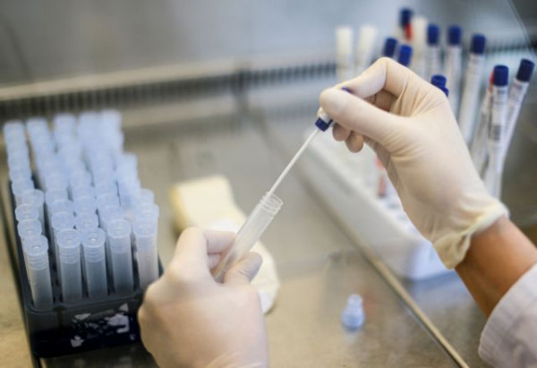 Σίδνεϊ – Εργαστήριο έδωσε λανθασμένη διάγνωση κοροναϊού σε εκατοντάδες άτομα