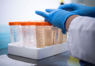 Κοροναϊός – Σαρηγιάννης – 50-60.000 κρούσματα τις επόμενες ημέρες – Πότε θα δούμε κορύφωση