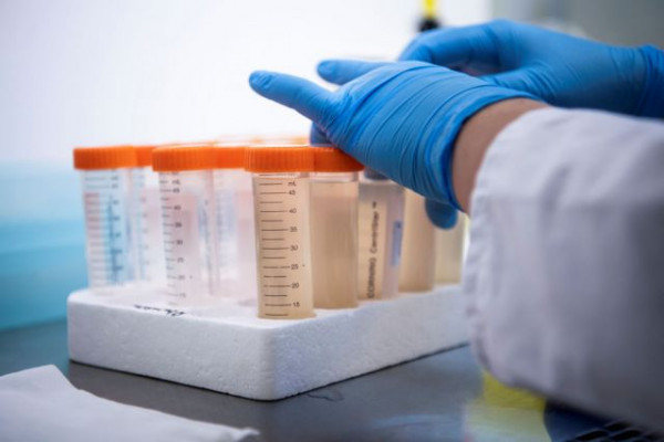 Κοροναϊός – Σαρηγιάννης – 50-60.000 κρούσματα τις επόμενες ημέρες – Πότε θα δούμε κορύφωση