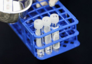 Έρευνα – Τα εμβόλια Covid-19 που γίνονται το απόγευμα φαίνεται να γεννούν περισσότερα αντισώματα