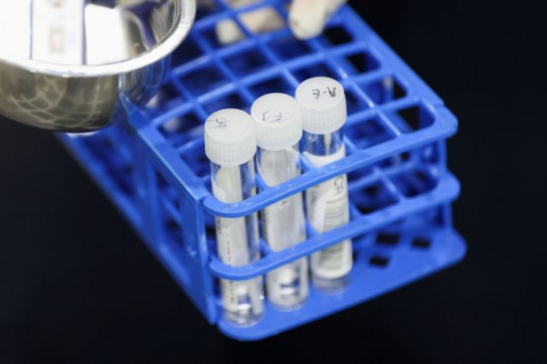 Έρευνα – Τα εμβόλια Covid-19 που γίνονται το απόγευμα φαίνεται να γεννούν περισσότερα αντισώματα