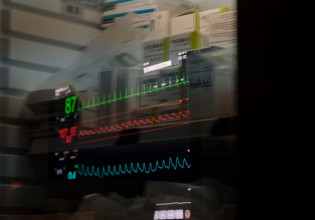 Μπόγδανος – Πρόβλεψη για 10.000 κρούσματα της Ομικρον