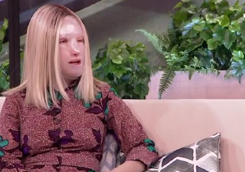 Ιωάννα Παλιοσπύρου – Συγκλονίζει ο ψυχίατρός της – «Το βιτριόλι σου έκαψε το δέρμα, όχι την ψυχή»