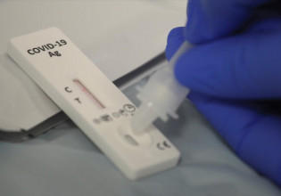 Κοροναϊος – Ξεκινά η διάθεση των δωρεάν self test από τα φαρμακεία – Πώς τα κάνουμε, αναλυτικές οδηγίες