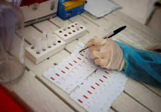 Όμικρον – Γιατί το rapid test βγαίνει αρνητικό στον κοροναϊό και το PCR θετικό;