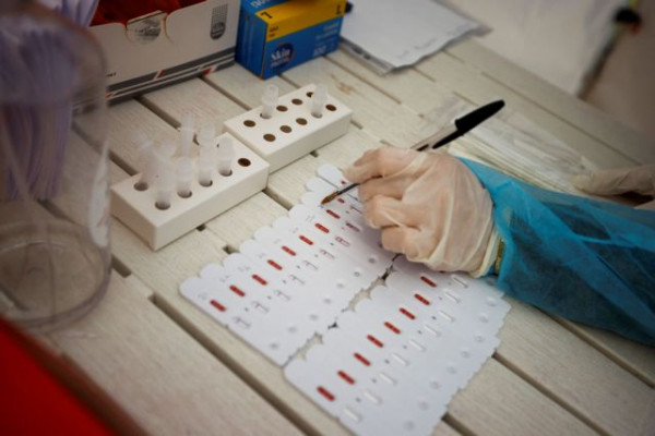 Όμικρον – Γιατί το rapid test βγαίνει αρνητικό στον κοροναϊό και το PCR θετικό;