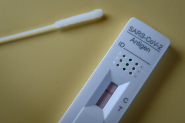 Κοροναϊος – Ξεκινά η διάθεση των δωρεάν self test για την περίοδο των εορτών