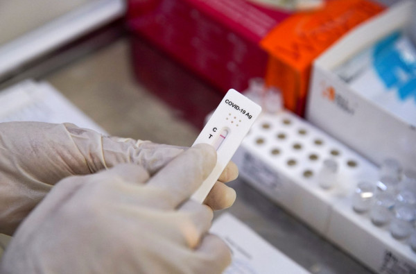 Μετάλλαξη Όμικρον – Πόσο αξιόπιστα είναι τα rapid test