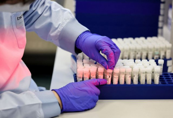 Κοροναϊός – Τι μπορεί να συμβαίνει όταν το PCR βγαίνει θετικό και το rapid test αρνητικό