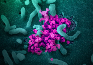 Κοροναϊός – Προτεραιότητα οι ασθενείς με αιματολογικό καρκίνο στα μονοκλωνικά αντισώματα