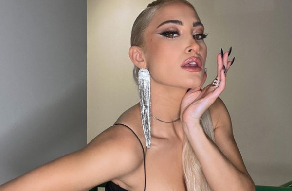 Ιωάννα Τούνη – Ατύχημα για την influencer – Τι αποκάλυψε μέσω Instagram