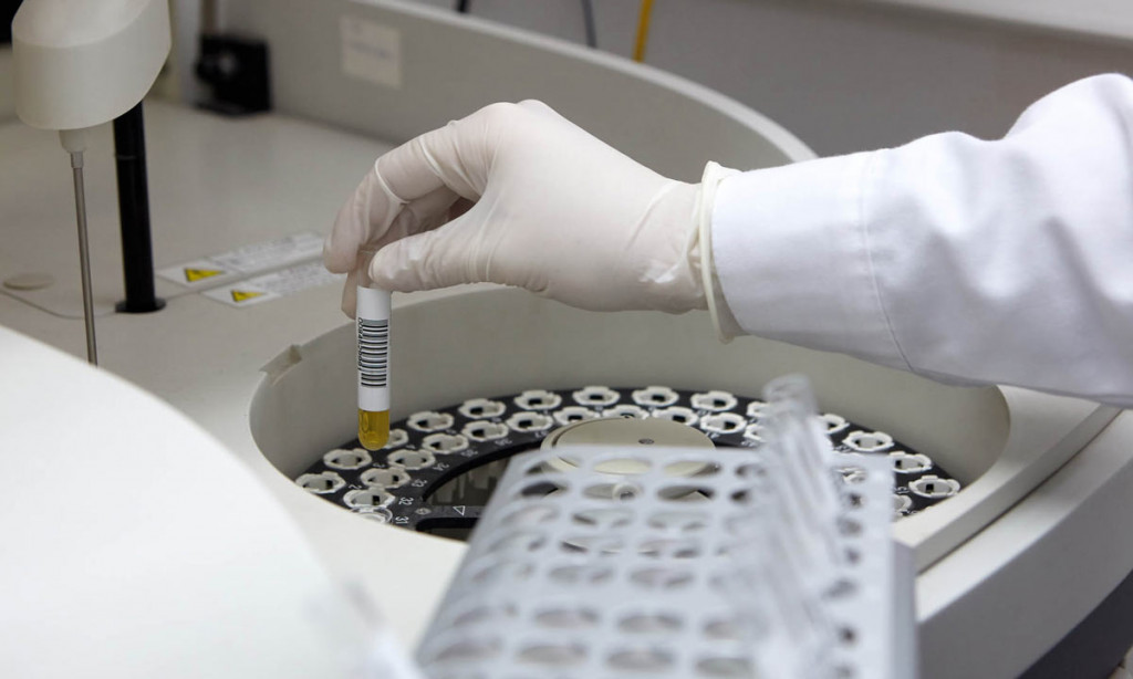 Πάτρα: Εξειδικευμένες εξετάσεις στο εξωτερικό για τα αίτια θανάτου της Τζωρτζίνας