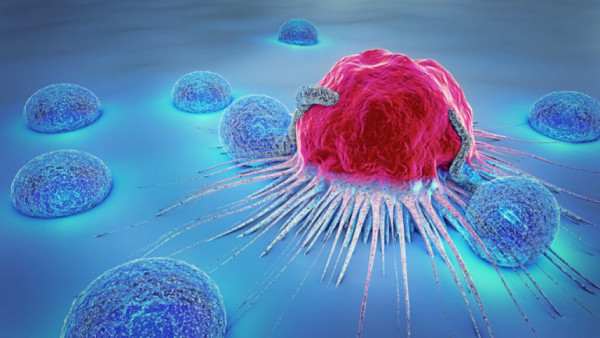 Έρευνα: Αυξήθηκε ο αριθμός των ασθενών με καρκίνο σε προχωρημένο στάδιο εξαιτίας του κοροναϊού