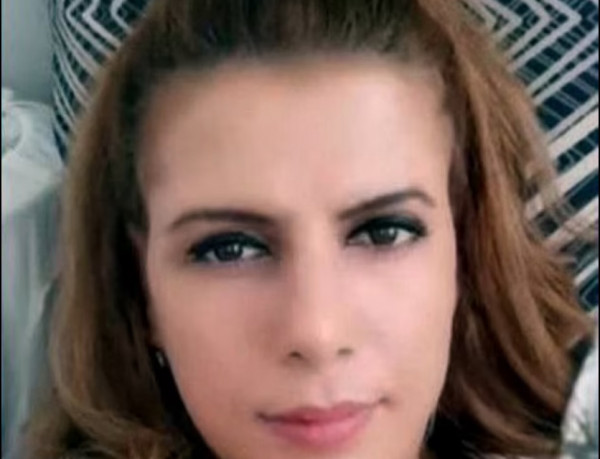 Τουρκία: Έκαψε την φίλη του στον ύπνο της γιατί τον απέρριψε