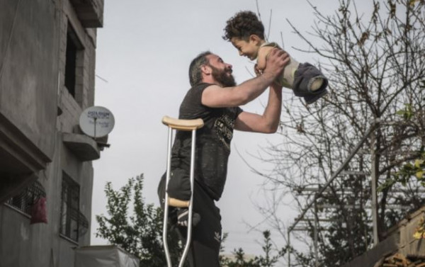 Ιταλία: Η νέα ζωή του Μουνζίρ και του Μουσταφά, συμβόλων της φρίκης του συριακού πολέμου