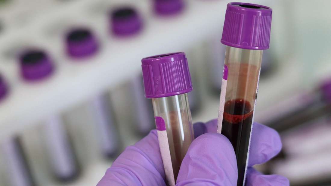 Κοροναϊός: Μεταδίδεται ο ιός μέσω της μετάγγισης αίματος;