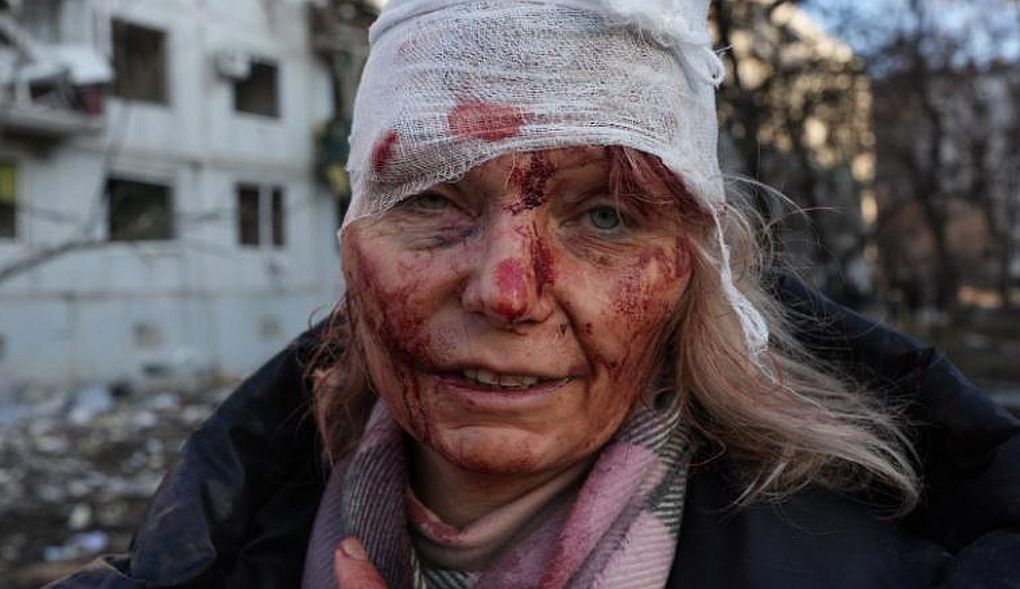 Πόλεμος στην Ουκρανία: Η γυναίκα που έγινε σύμβολο εξομολογείται -  «Είχα φύλακα άγγελο»
