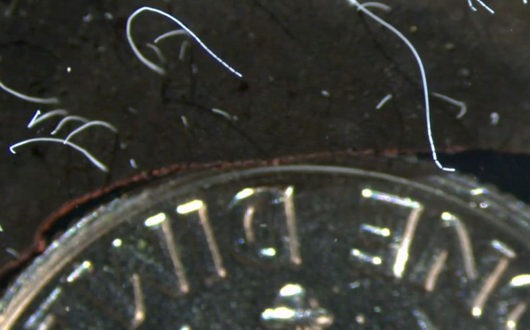 Έρευνα: Ανακαλύφθηκε το μεγαλύτερο μικρόβιο στον κόσμο