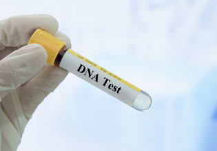 Βρετανία: Υπό ανάπτυξη τεστ DNA που ανιχνεύει πολλές νευρολογικές παθήσεις