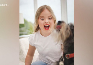 Βρετανία: Μοντέλο με σύνδρομο Down «σπάει» τα στερεότυπα