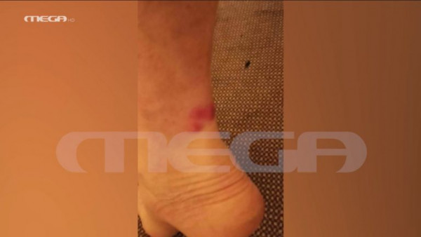 Αποκάλυψη MEGA: Άθλιες συνθήκες στις καμπίνες του «Euroferry Olympia» – Εικόνες που σοκάρουν