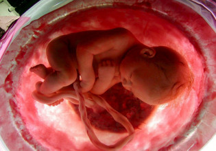 Κοροναϊός: Ασυνήθιστος μηχανισμός φαίνεται πως προστατεύει τα έμβρυα