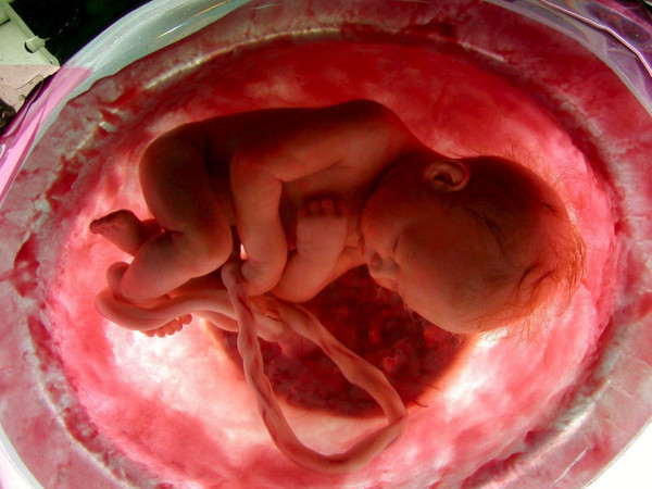 Κοροναϊός: Ασυνήθιστος μηχανισμός φαίνεται πως προστατεύει τα έμβρυα