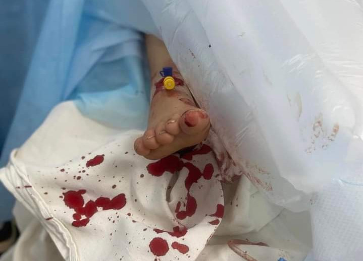 Πόλεμος στην Ουκρανία: Δραματικές ώρες στο Κιέβο - Χτυπήθηκε νοσοκομείο, ένα παιδί νεκρό