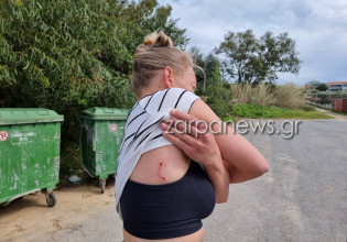 Κρήτη: Τραυματίστηκε γυναίκα από επίθεση σκύλου – Μεταφέρθηκε σε νοσοκομείο