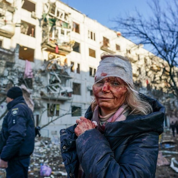 Ουκρανία: H φωτογραφία με την τραυματισμένη γυναίκα που συγκλονίζει