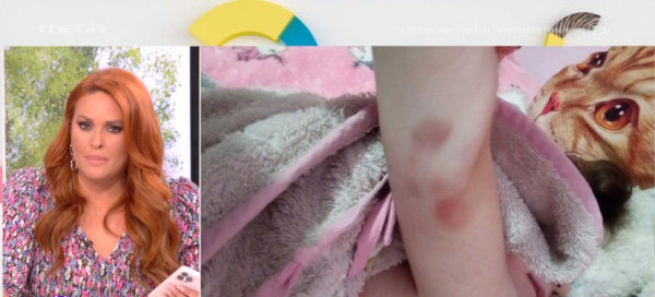 Πάτρα: «Το ενδιαφέρον της μητέρας για τη Τζωρτζίνα ήταν αμείωτο» – Ψευδείς μαρτυρίες καταγγέλλει επαγγελματίας υγείας