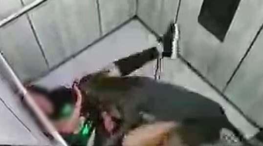 Κολομβία: Γυναίκα δέχεται άγρια επίθεση από τον σκύλο της – Πώς κατάφερε να σωθεί [Σκληρές εικόνες]