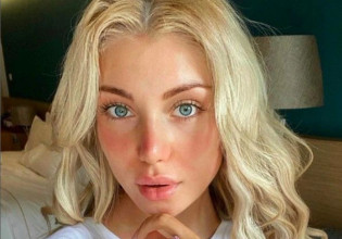 Ρωσίδα μοντέλο που αποκάλεσε «ψυχοπαθή» τον Πούτιν βρέθηκε νεκρή σε βαλίτσα