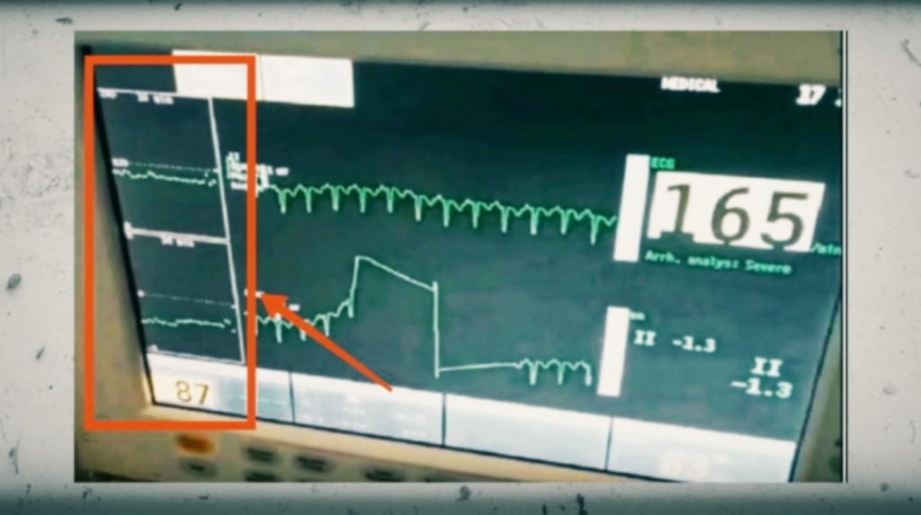 Πάτρα: Η μυστηριώδης βραδυκαρδία της Τζωρτζίνας πριν ειδοποιηθούν οι γιατροί – Εικόνα – ντοκουμέντο