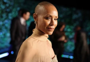 Πώς είναι για μια γυναίκα να χάνει τα μαλλιά της (και γιατί ο Κρις Ροκ είναι απαράδεκτος)