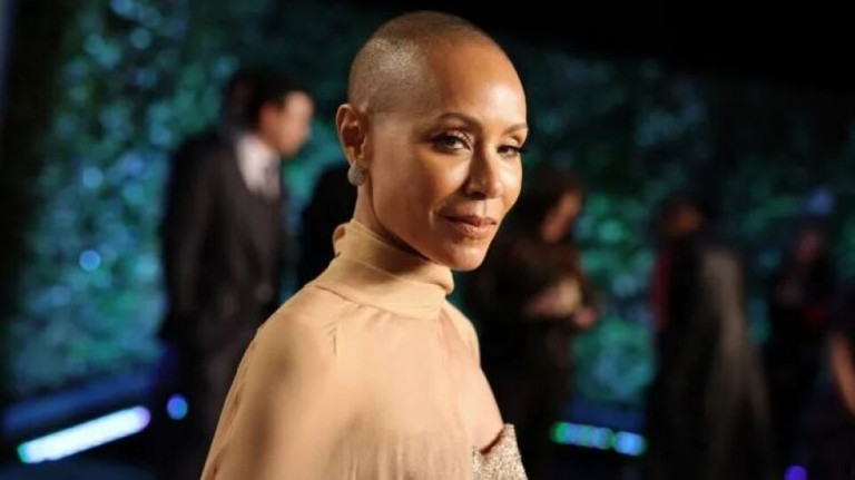 Πώς είναι για μια γυναίκα να χάνει τα μαλλιά της (και γιατί ο Κρις Ροκ είναι απαράδεκτος)