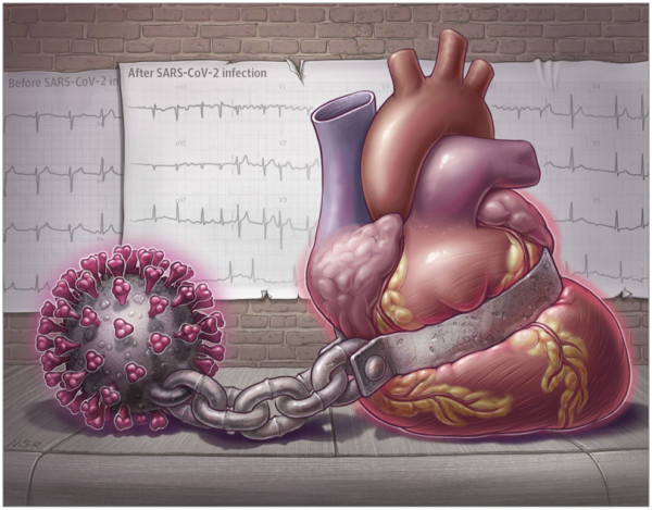 Κίνδυνος για την καρδιά ο κοροναϊός ακόμα και στην ήπια νόσηση