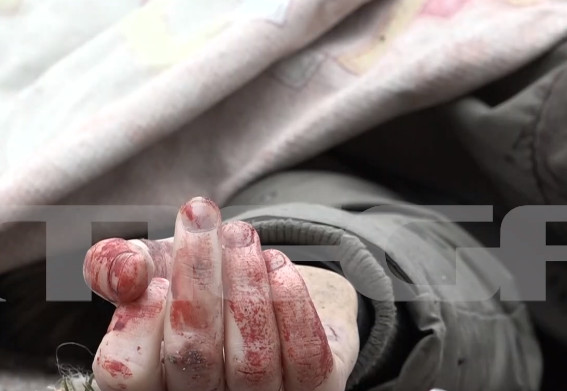 Πόλεμος στην Ουκρανία: Το MEGA στον βομβαρδισμό του Ιρπίν - Αποκλειστικό βίντεο που «παγώνει» το αίμα