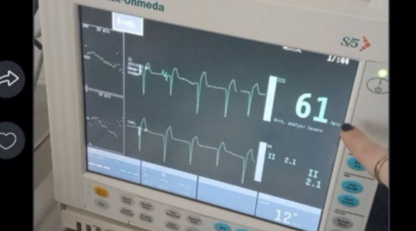 Πάτρα: Το στοιχείο σοκ για τους σφυγμούς της Τζωρτζίνας πριν ειδοποιηθούν οι γιατροί