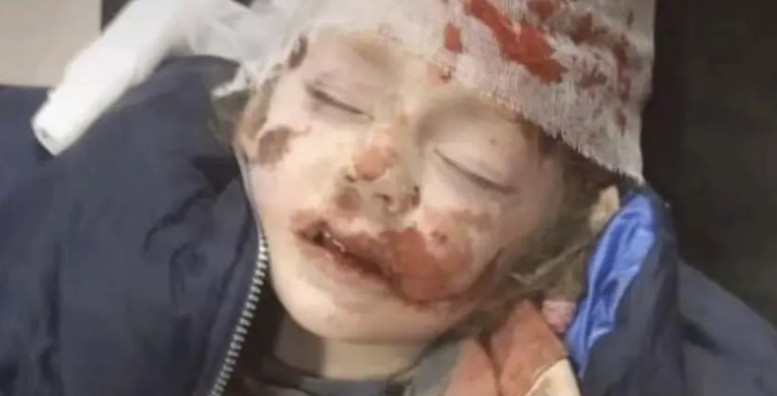 Πόλεμος στην Ουκρανία: Νύχτα κόλαση έφεραν οι Ρώσοι στην πόλη Σούμι – Βομβάρδισαν παιδιά και αμάχους