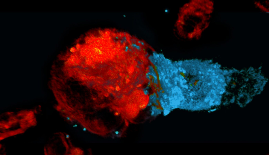 Νέα γενιά θεραπειών στοχεύει στο προφίλ της ασθένειας και του ασθενή